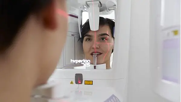 Diagnostik Röntgen