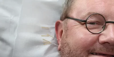 Ohrakupunktur nach Nogier